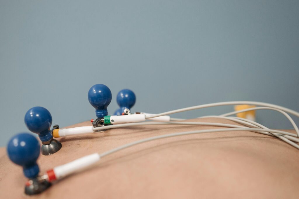 Detailed image of ECG electrodes on a patient's chest, capturing a medical procedure.